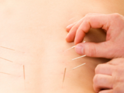 What Can Acupuncture Treat